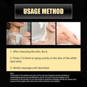 รักษาด่างขาว