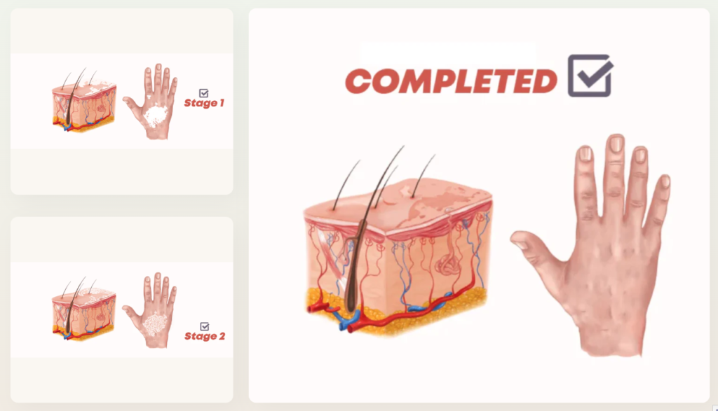 ขั้นตอนรักษาด่างขาว