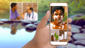 Read more about the article การรักษาโรคด่างขาวอย่างมีประสิทธิภาพ