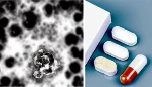 Read more about the article ทำความรู้จักกับโรคด่างขาว