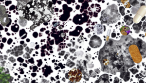 Read more about the article ด่างขาว: ทุกสิ่งที่คุณต้องรู้