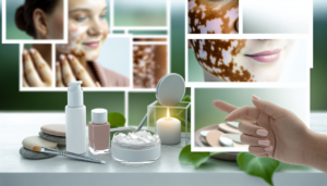 Read more about the article รักษาด่างขาว: วิธีการและแนวทางในการดูแลรักษา